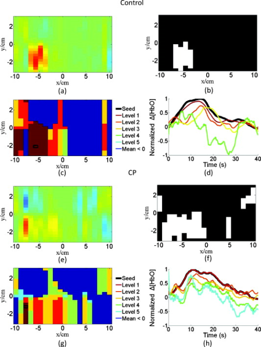 Identification of abnormal motor cortex activation patterns in children ...