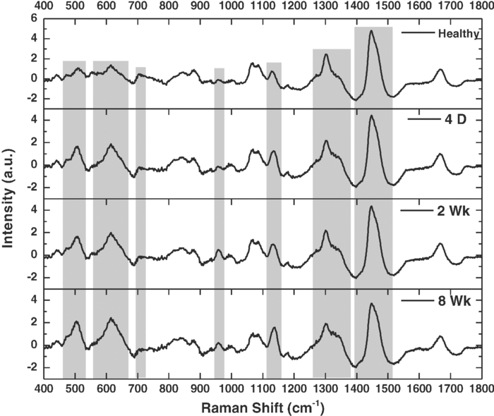 Raman spectroscopic investigation of spinal cord injury in a rat model