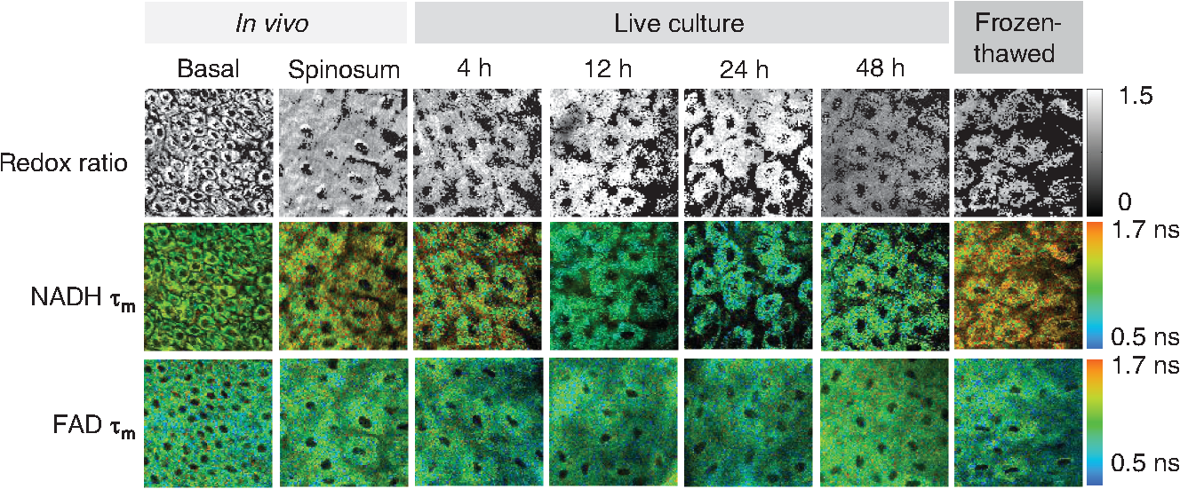 In-vivo validation imaging of a hamster cheek pouch: (A) fluorescence