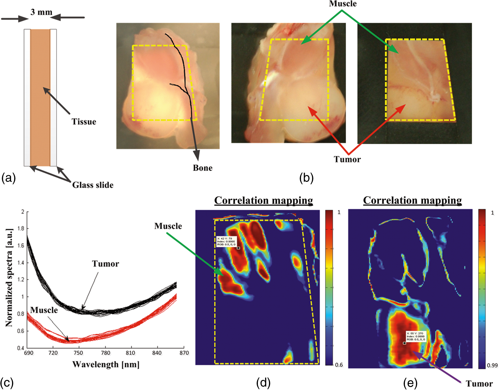 medical hyperspectral imaging a