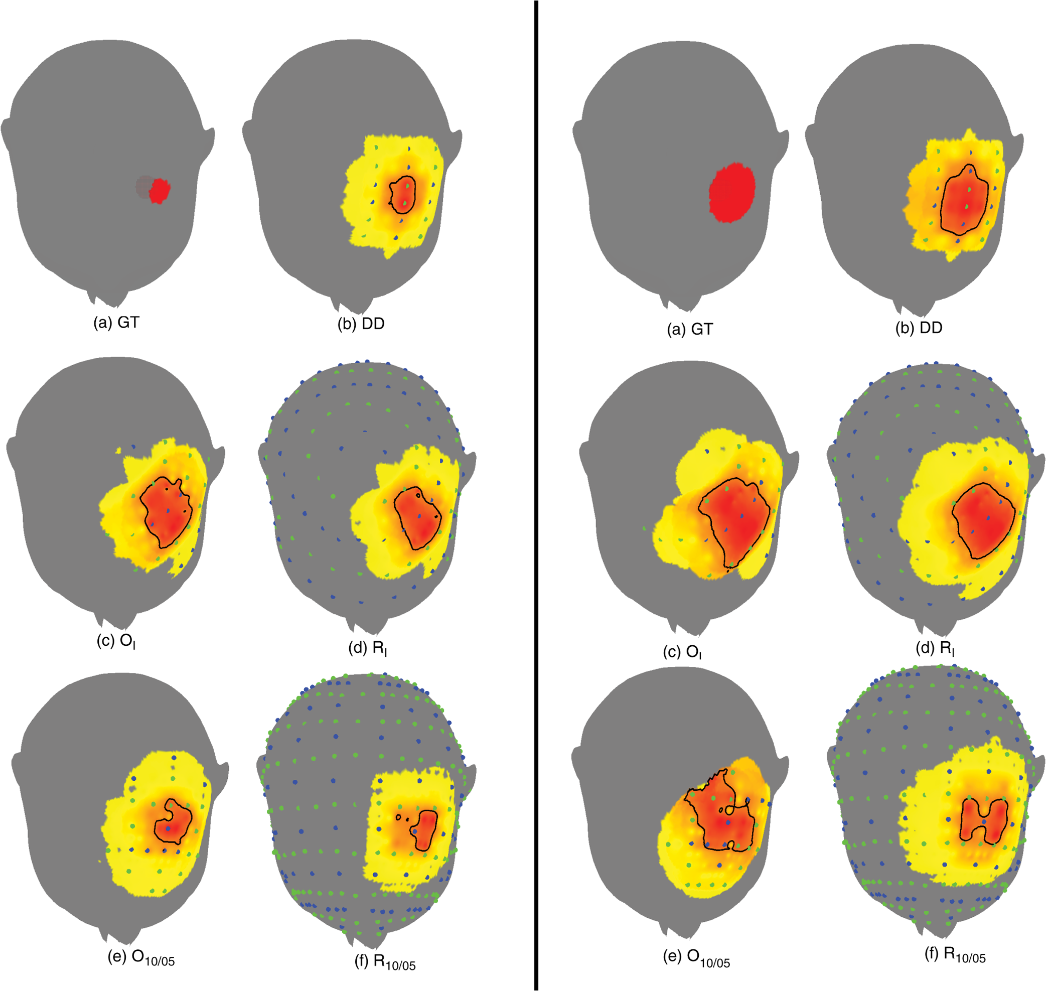 Optode Cap Optimal optode montage on electroencephalography/functional near ...
