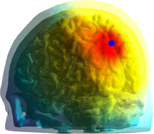The Toast++ software suite for forward and inverse modeling in optical ...