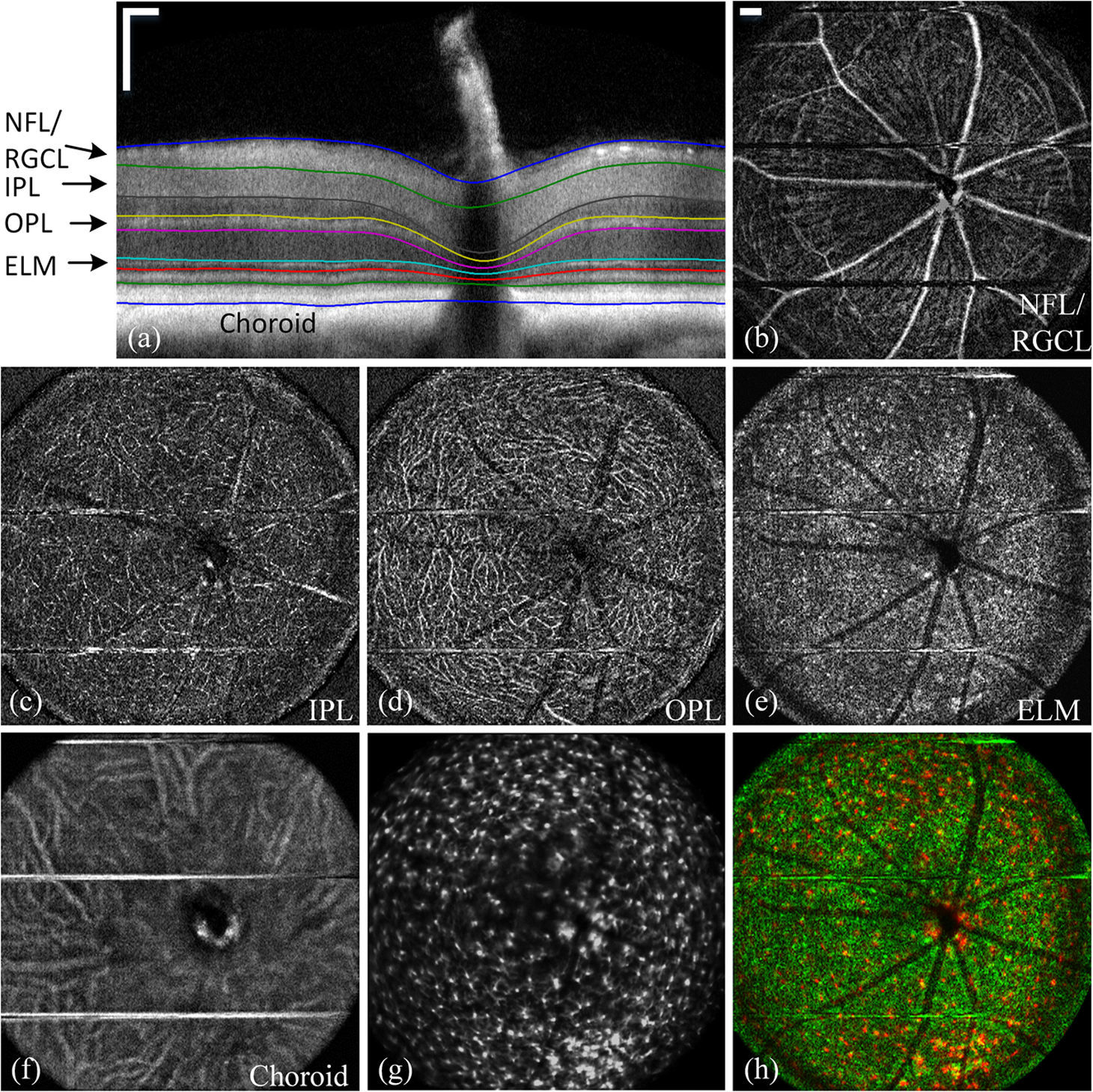 In Vivo Wide Field Multispectral Scanning Laser Ophthalmoscopy In Vivo Wide Field Multispectral Scanning Laser Ophthalmoscopy