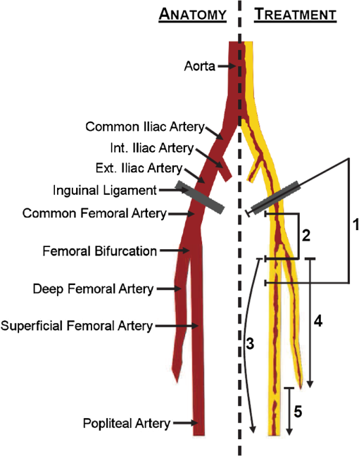 Femoral Artery Anatomy Anatomy Diagram Source