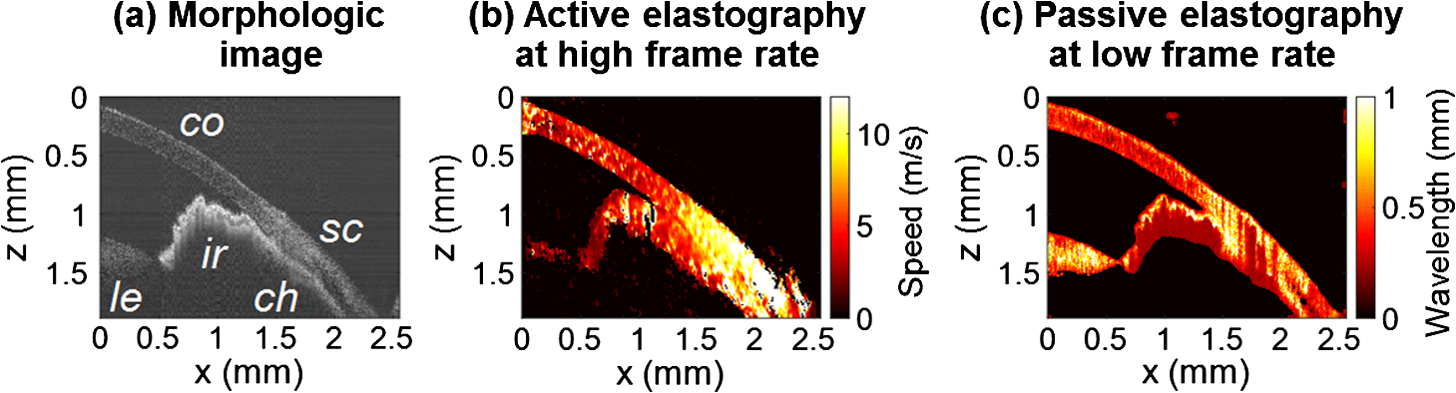 Diffuse Shear Wave Imaging Toward Passive Elastography Using Low