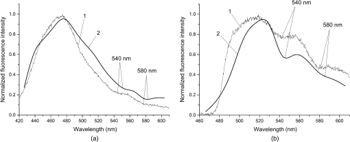 Computational Model Of Bladder Tissue Based On Its Measured Optical Properties