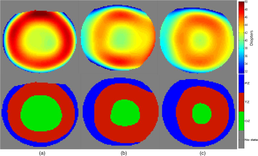 JBO_21_7_075011_f001.png