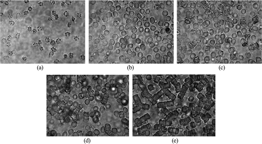Descriptive parameters of the erythrocyte aggregation phenomenon using ...