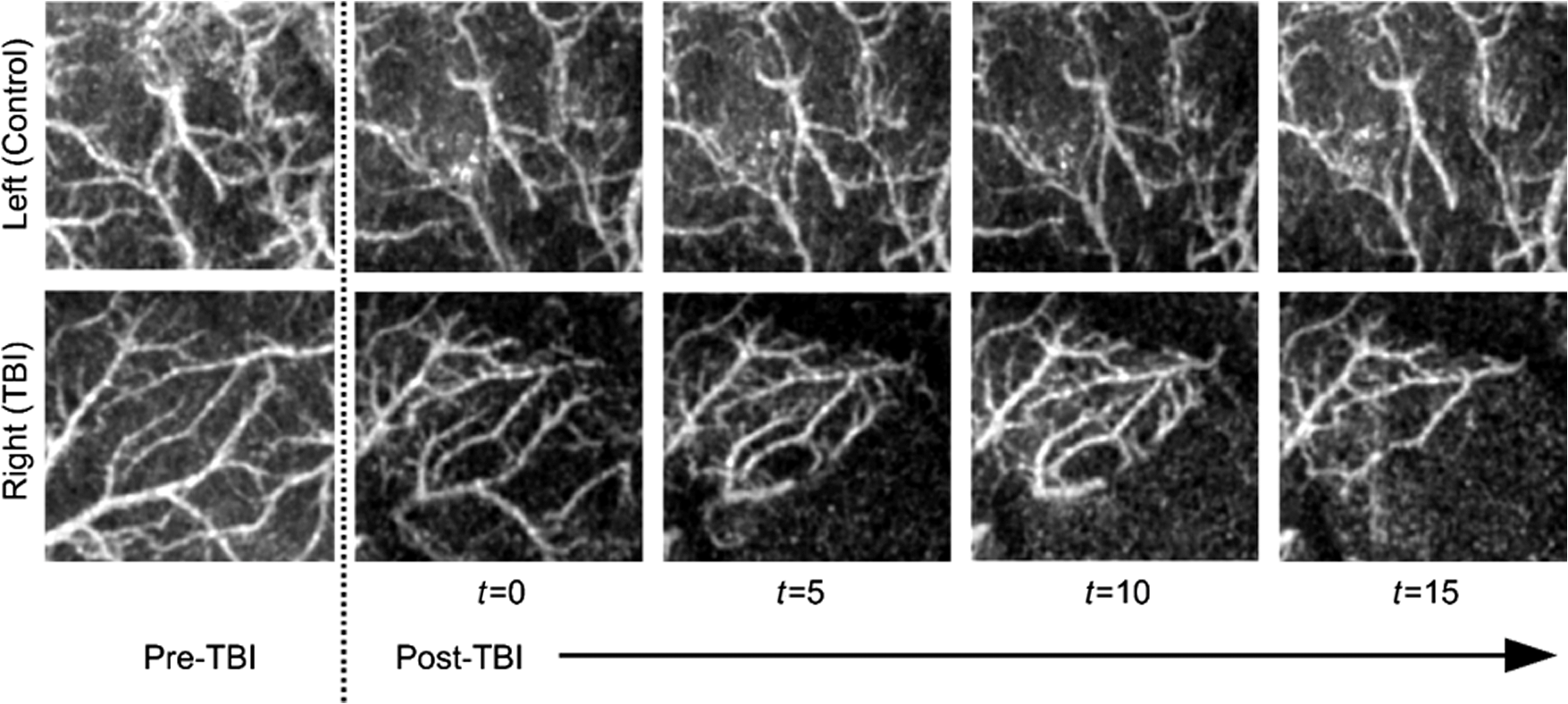 Angiography Mouse Heart-rate sensitive optical coherence angiography for measuring ...