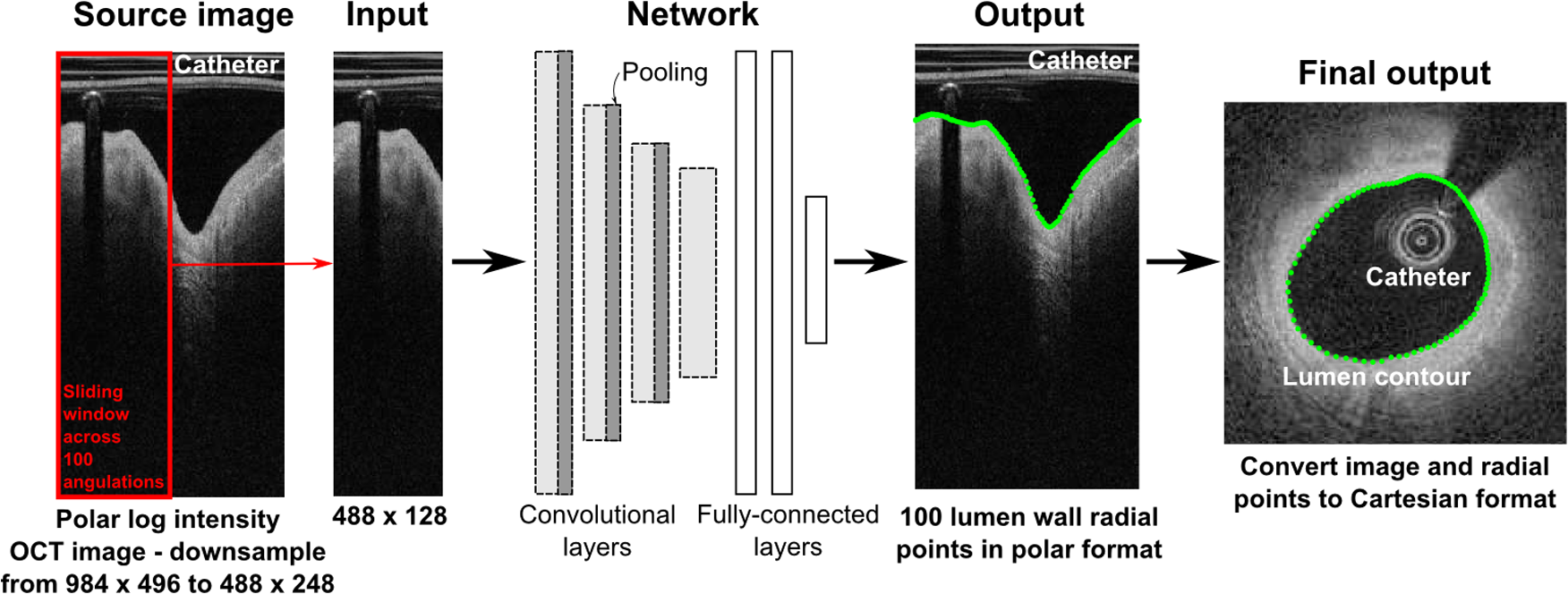 Regression convolutional neural sales network
