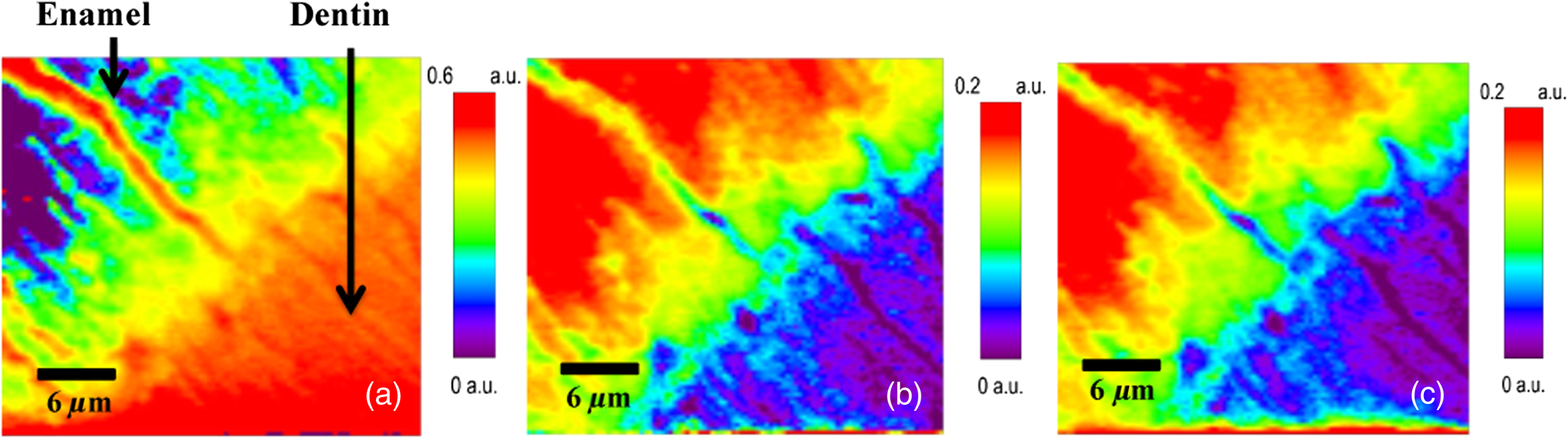Confocal Raman mapping of collagen cross-link and crystallinity of ...