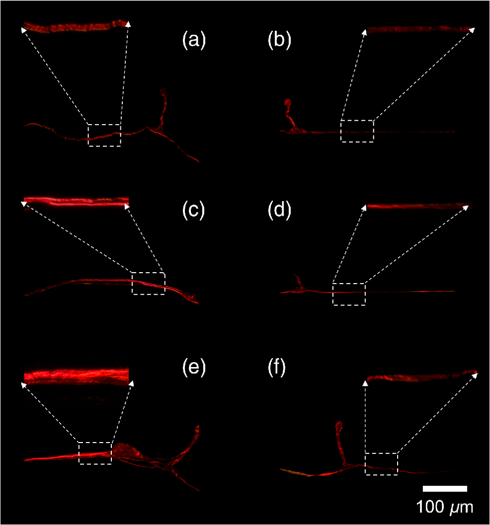 Laser Induced Tissue Remodeling Within The Tympanic Membrane