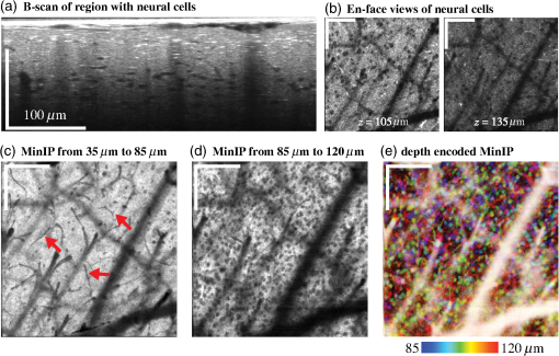 In vivo high-resolution cortical imaging with extended-focus optical ...