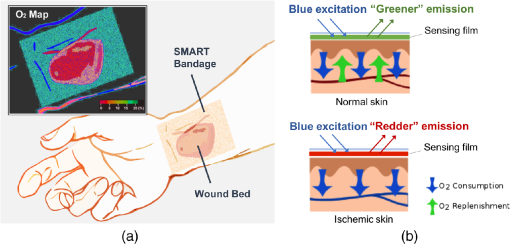 Sensing, monitoring, and release of therapeutics: the translational journey  of next generation bandages