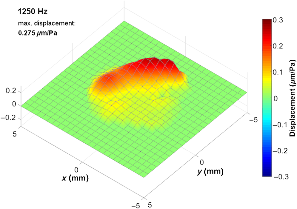 Oscillation map of a human Tympanic Membrane in vivo at 1250 Hz