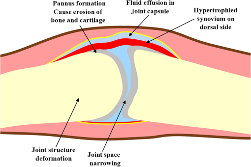 JBO_24_6_066008_f001.png
