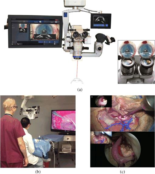 Comprehensive review of surgical microscopes: technology