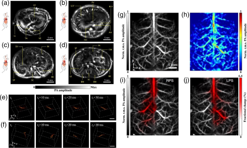 Contactless optical coherence tomography of the eyes of