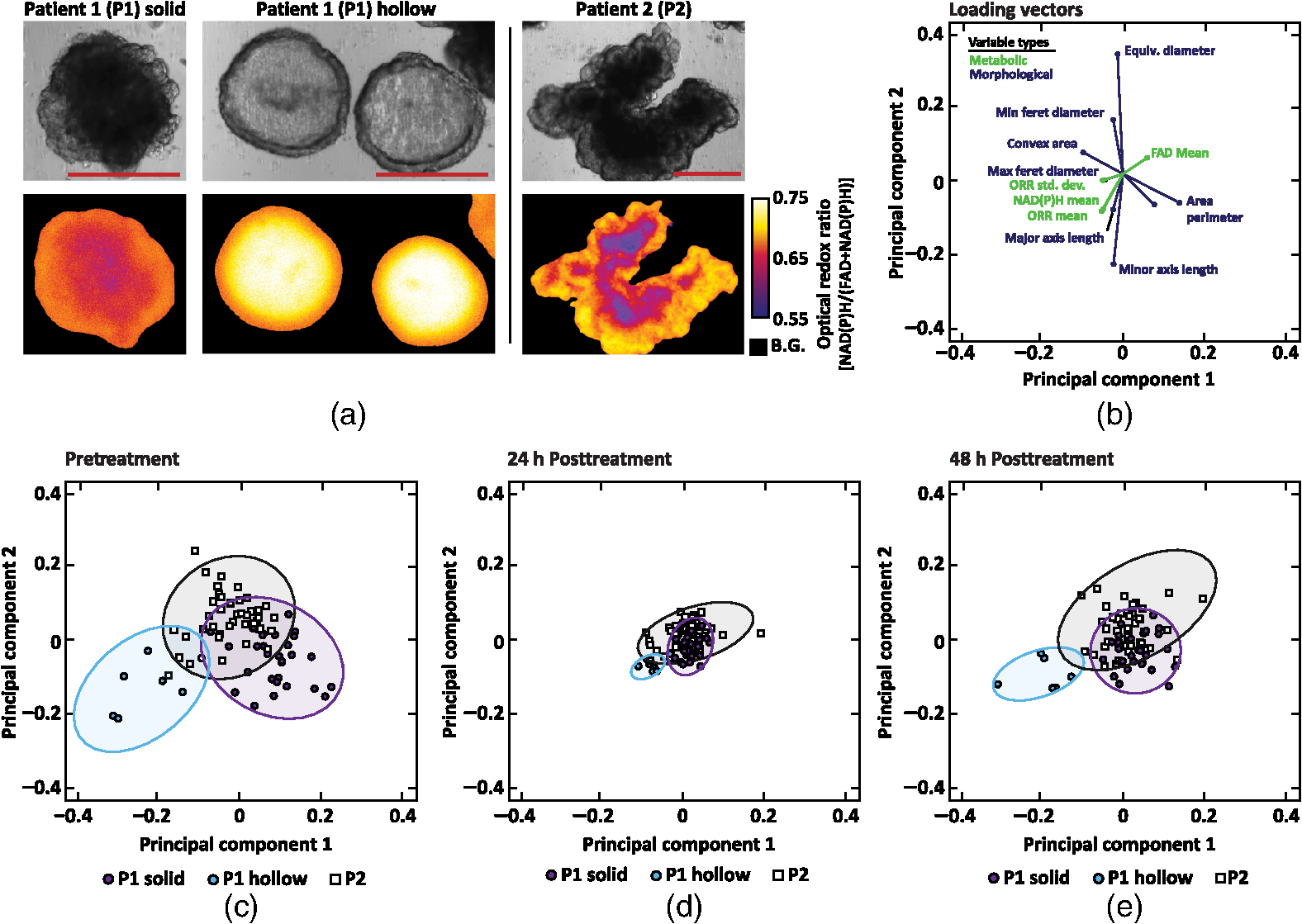 Patient Derived Cancer Organoid Tracking With Wide Field One Photon Redox Imaging To Assess Treatment Response Patient Derived Cancer Organoid Tracking With Wide Field One Photon Redox Imaging To Assess Treatment Response