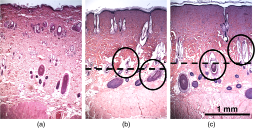 JBO_26_8_086001_f005.png