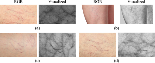 Vein Pattern Color Visualizing veins from color images under varying illuminations for ...