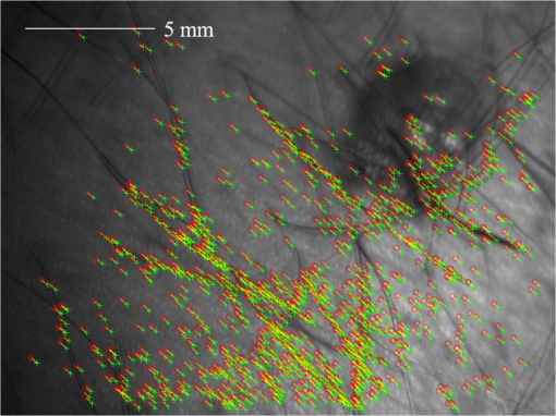 JBO_27_9_096001_f014.png