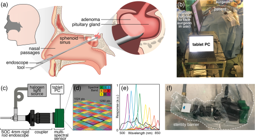 First-in-human pilot study of snapshot multispectral endoscopy for ...