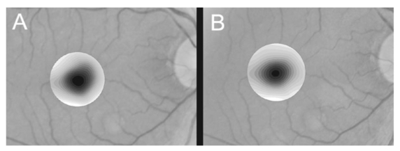 Photographic patterns in macular images: representation by a ...