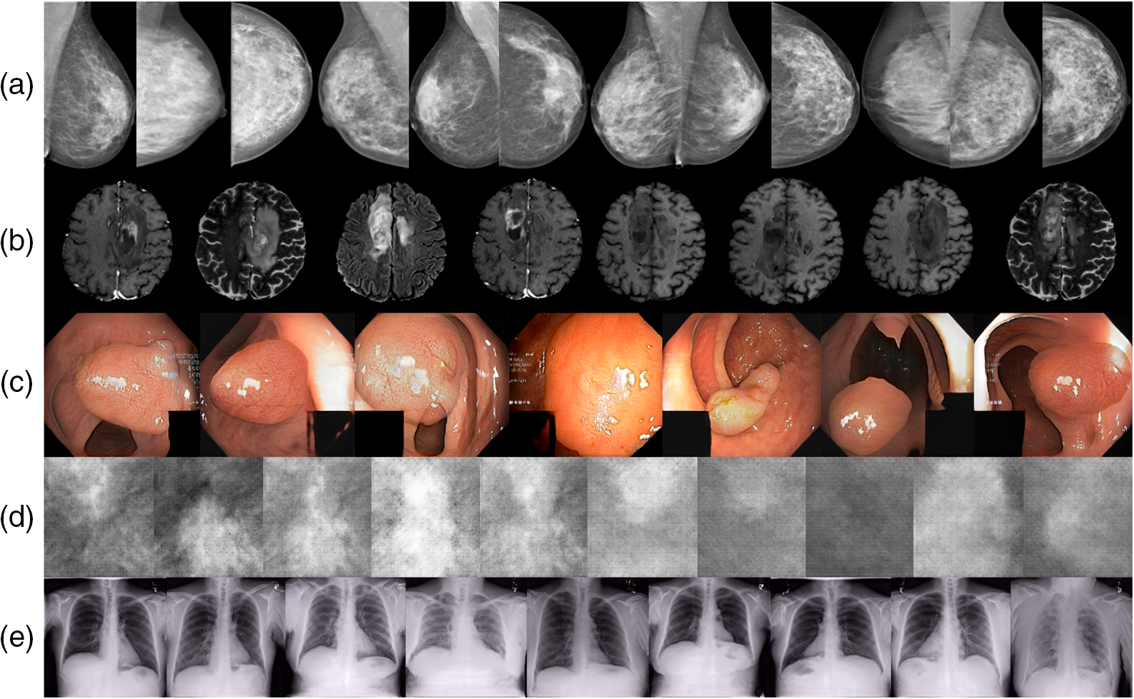 medigan: a Python library of pretrained generative models for medical ...