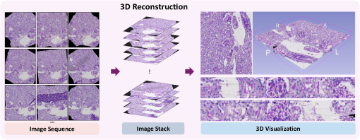 ZeroReg3D: a zero-shot registration pipeline for 3D consecutive ...
