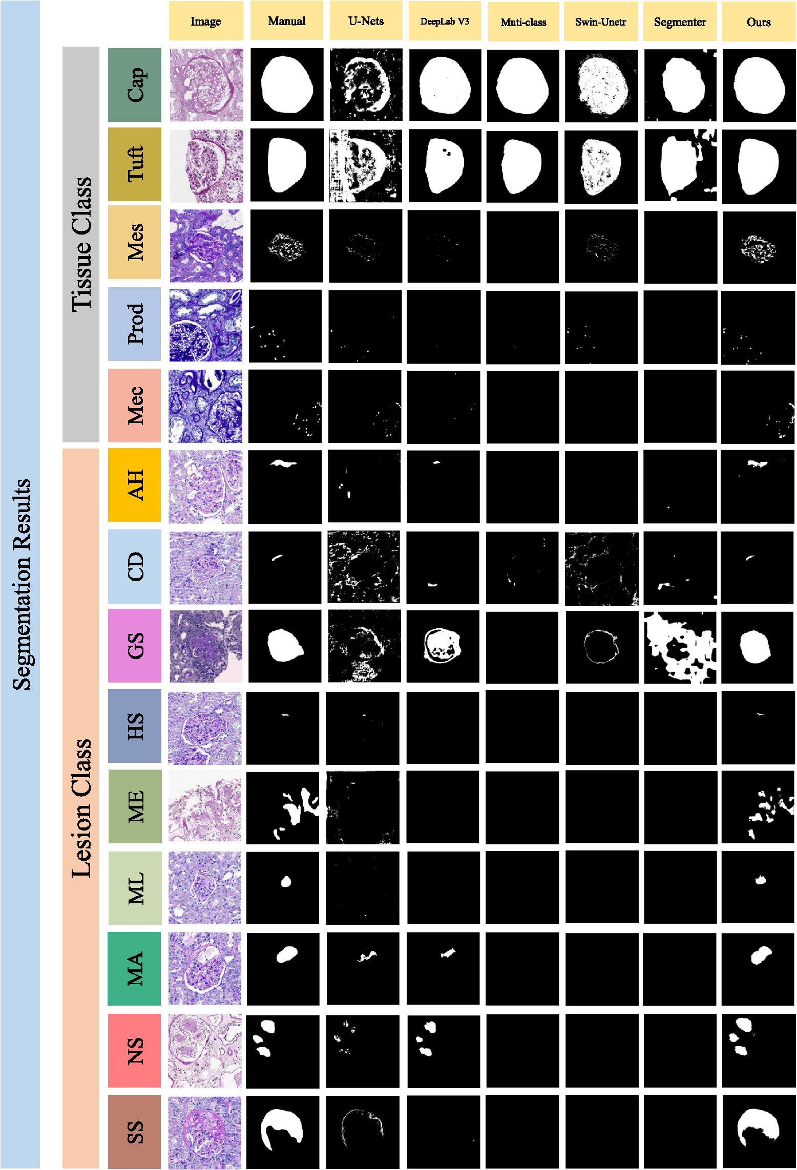 Glo-In-One-v2: holistic identification of glomerular cells, tissues ...