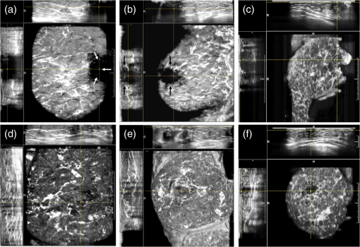 JMI_3_2_027002_f001.png