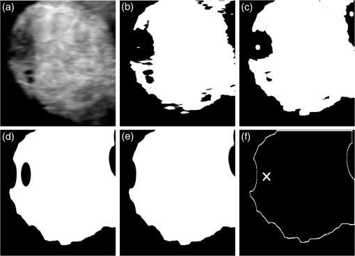 JMI_3_2_027002_f003.png
