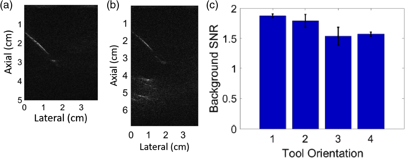 Feasibility of photoacoustic-guided teleoperated 