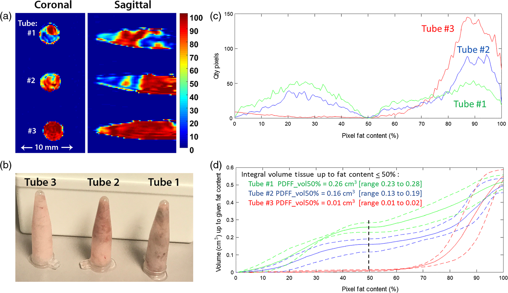 Obese Magnet Color Water–fat magnetic resonance imaging quantifies relative proportions of ...