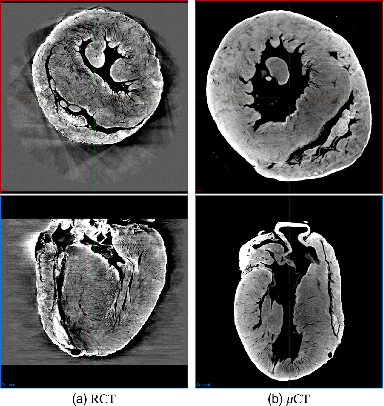 Cardiac Fiber Tracking On Super High Resolution Ct Images A Comparative Study