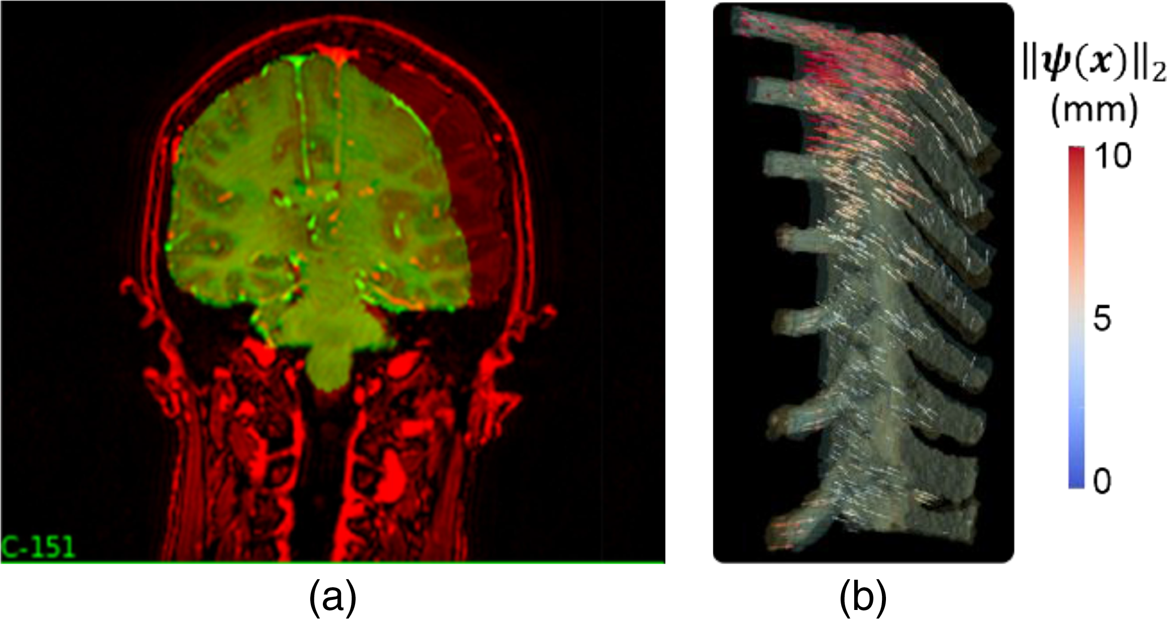 JMI_9_S1_012206_f006.png