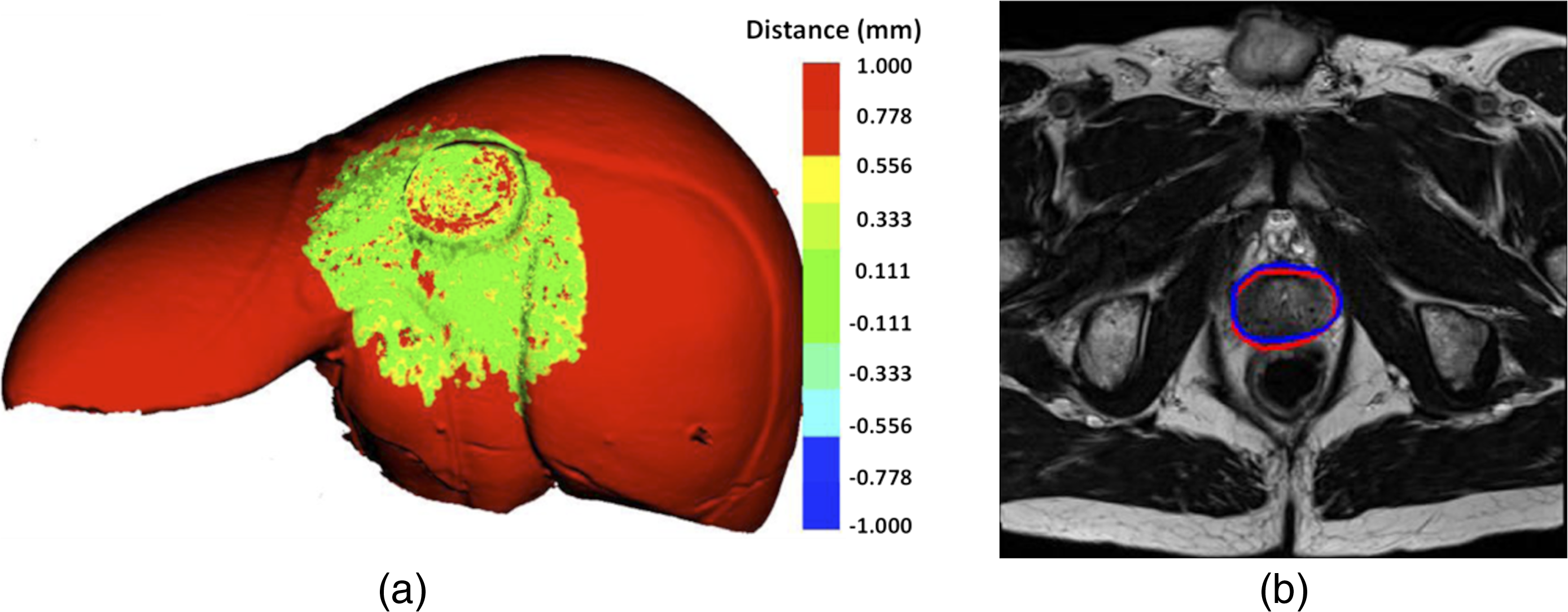 JMI_9_S1_012206_f007.png