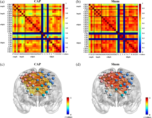 Cortical functional connectivity and topology based on complex network ...