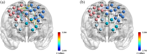 Cortical functional connectivity and topology based on complex network ...