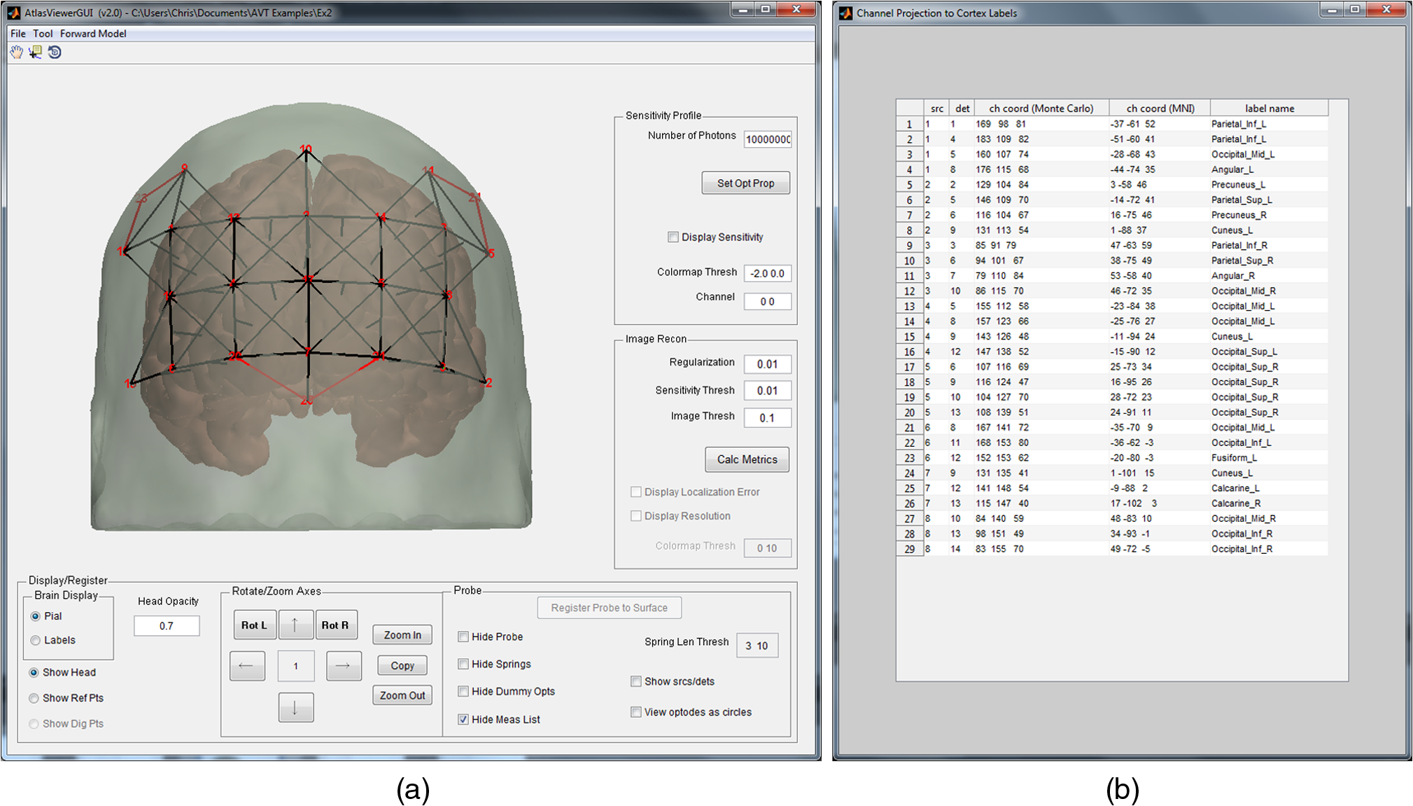 Anatomical guidance for functional near-infrared Anatomical guidance for functional near-infrared