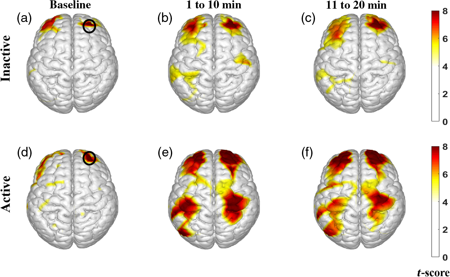 Mapping Cortical Network Effects Of Fatigue During A Handgrip Task By Functional Near Infrared Spectroscopy In Physically Active And Inactive Subjects Mapping Cortical Network Effects Of Fatigue During A Handgrip Task By Functional Near Infrared Spectroscopy In Physically Active And Inactive Subjects