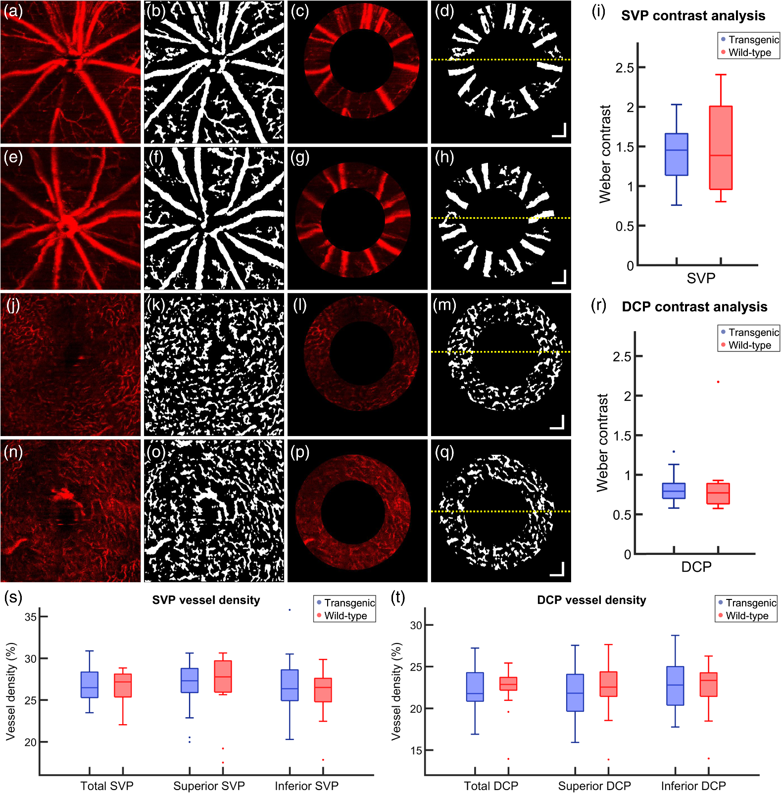 Retinal Analysis Of A Mouse Model Of Alzheimer S Disease With Multicontrast Optical Coherence Tomography