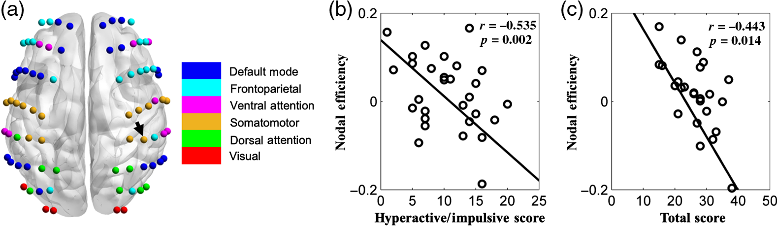 Disrupted functional brain connectivity networks in children with ...