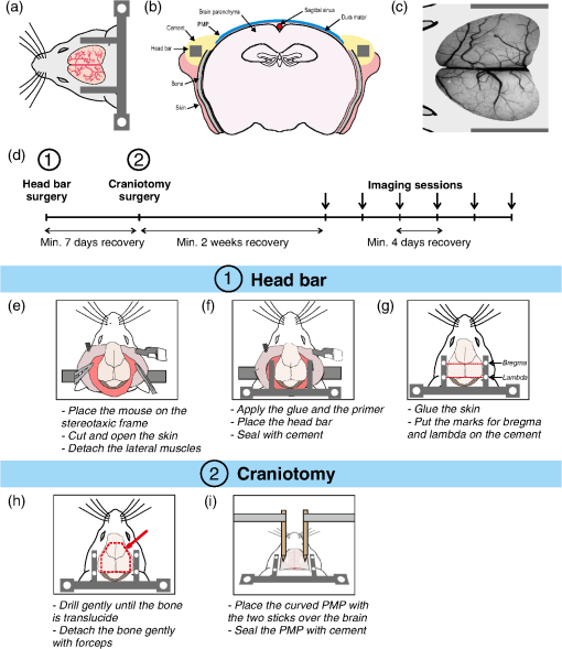 Figure 1 from Brain surface temperature under a craniotomy.