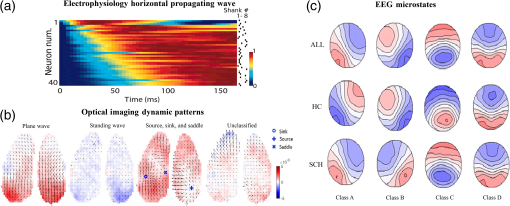 Spatiotemporal patterns of spontaneous brain activity: a mini-review