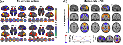 Spatiotemporal patterns of spontaneous brain activity: a mini-review