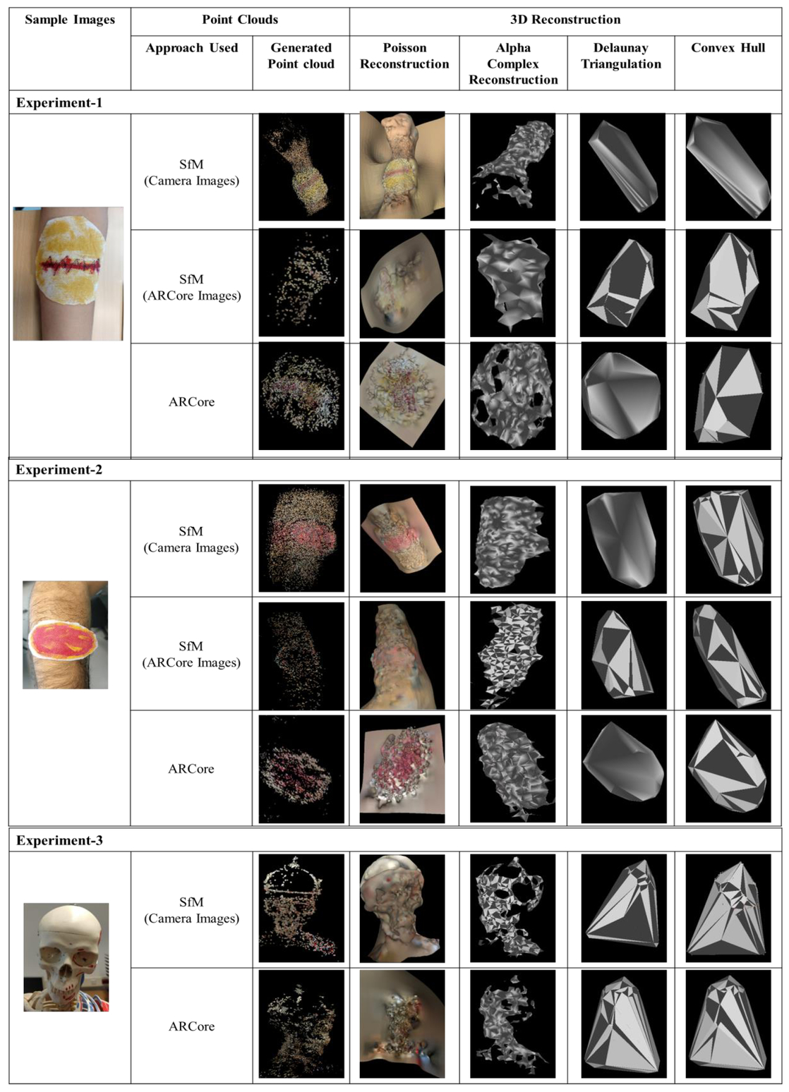 A Comparison Of Open Source Libraries Ready For 3d Reconstruction Of Wounds