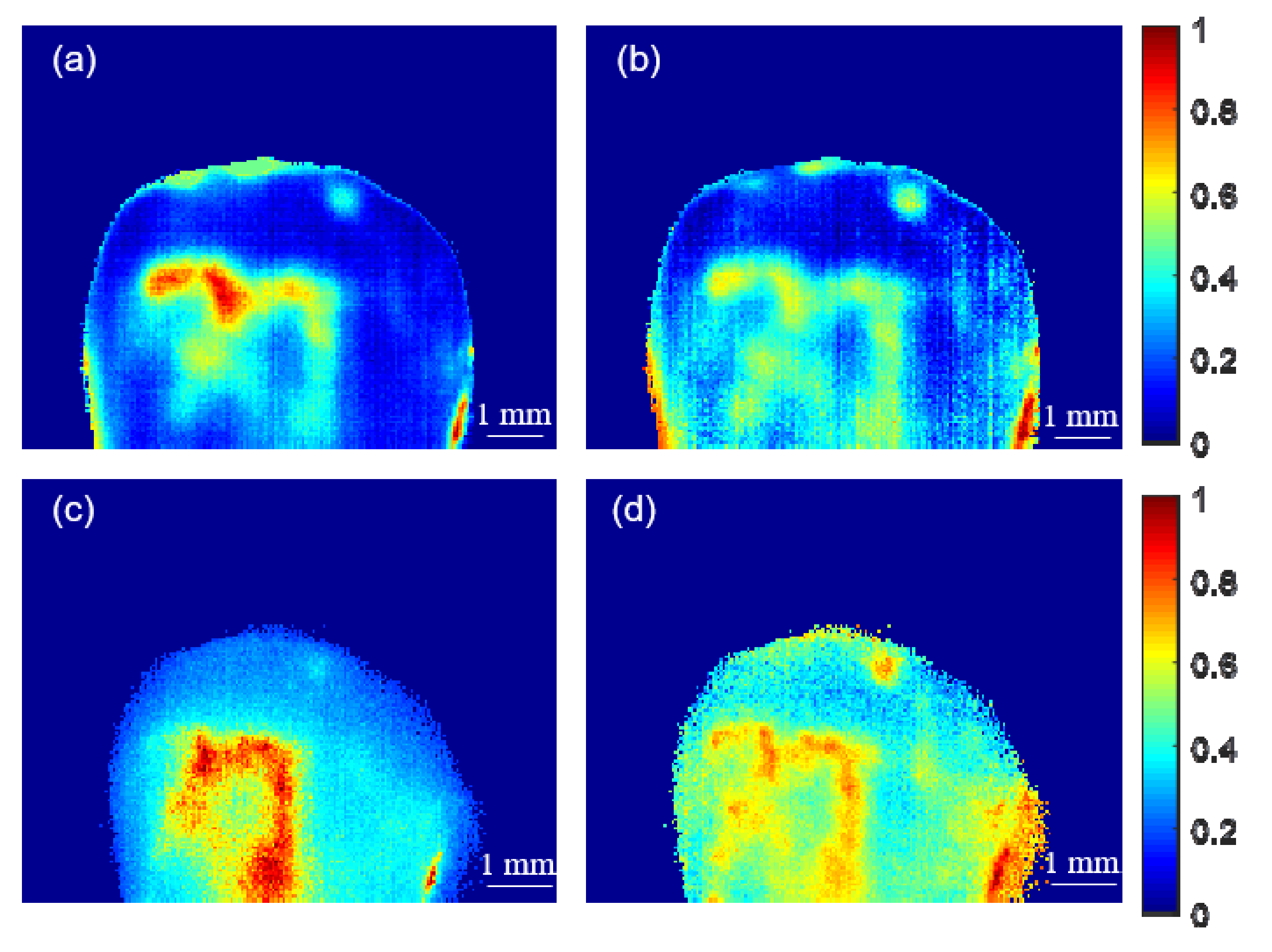 Comparison Of Low Cost And Research Grade Active Thermography Platforms For Detection Of Early Dental Caries