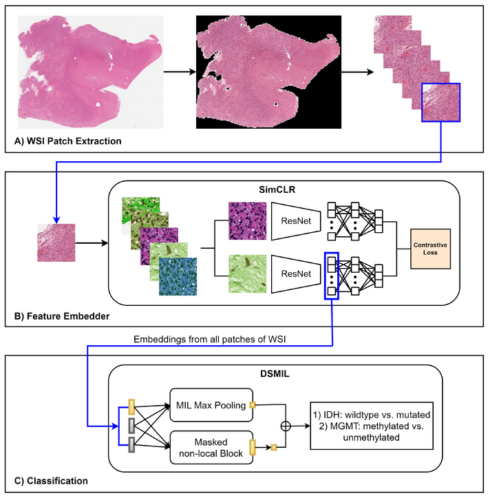 Self-supervised deep learning to predict molecular markers from routine histopathology slides for high-grade glioma tumors